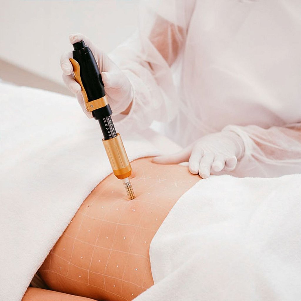 Caneta Pressurizada Para Mesoterapia Intradermoterapia Manual Facial E Corporal